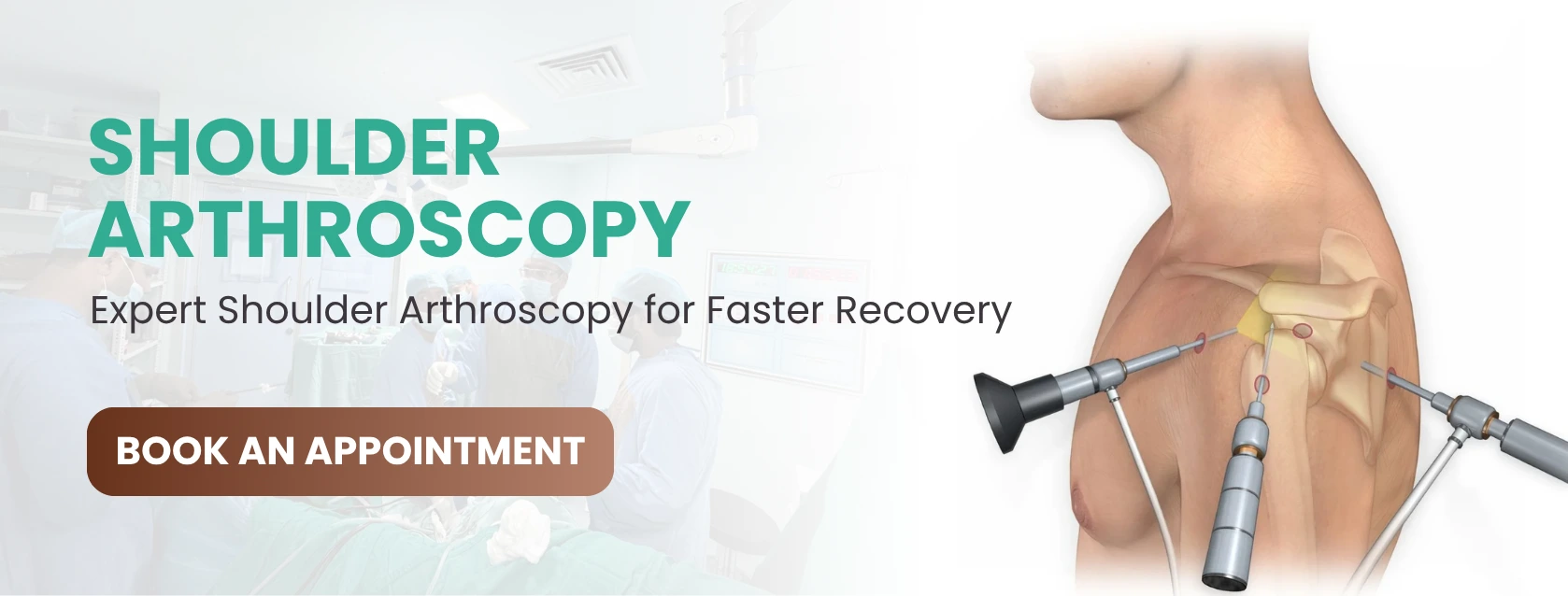 Shoulder Arthroscopy